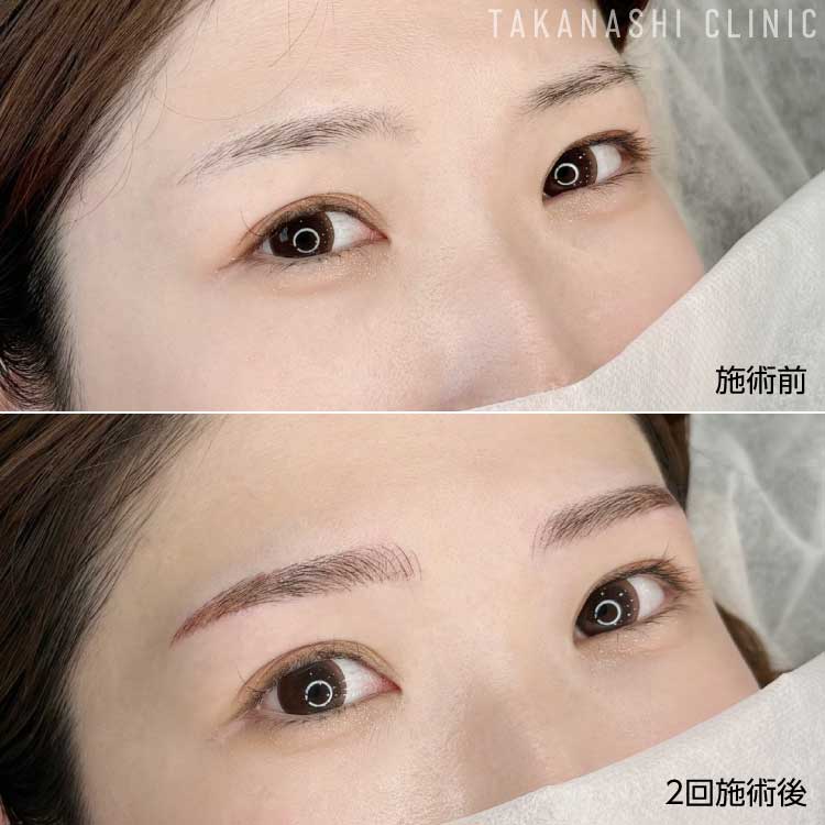 症例写真