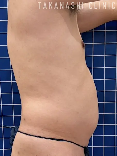 施術前（別角度1）