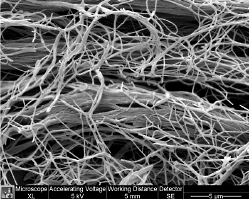 電子顕微鏡写真：マトリコール®のコラーゲン組織構造