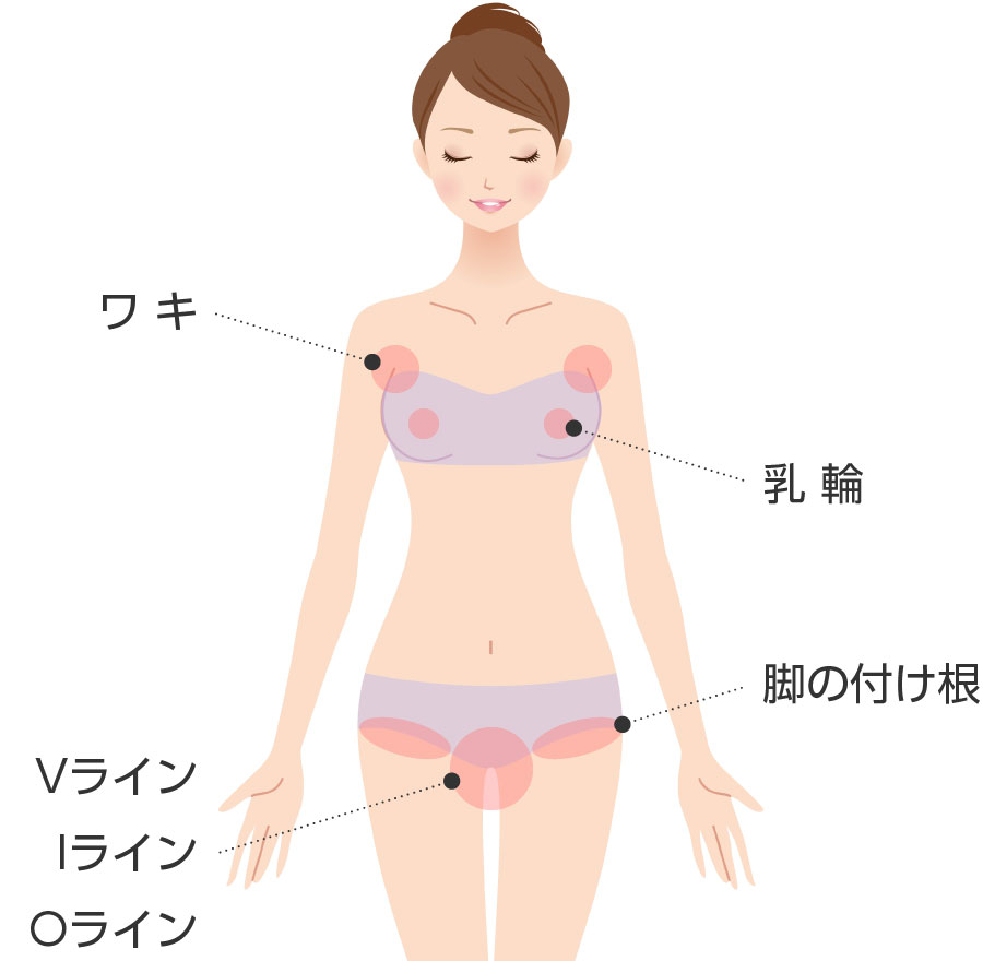 Vライン、Iライン、Oライン、乳輪、ワキ、脚の付け根