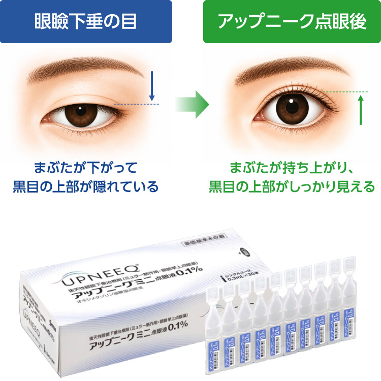 アップニーク製品イメージ